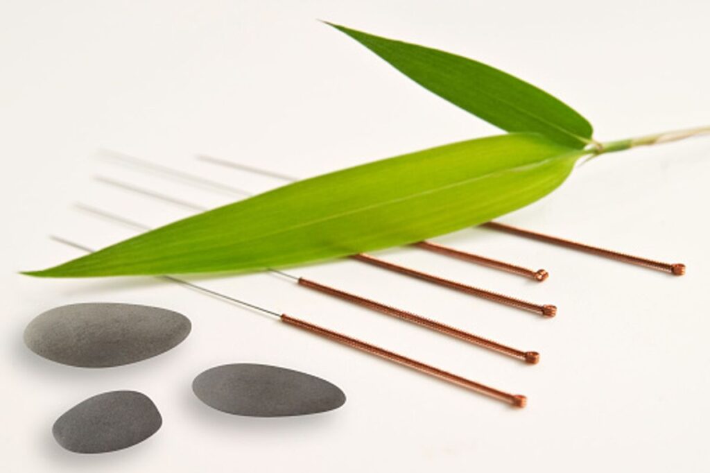 Acupuncture therapy and IVF – They have Proven it Helps?