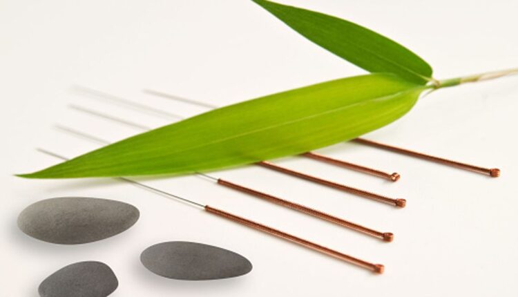 best acupuncture NYC