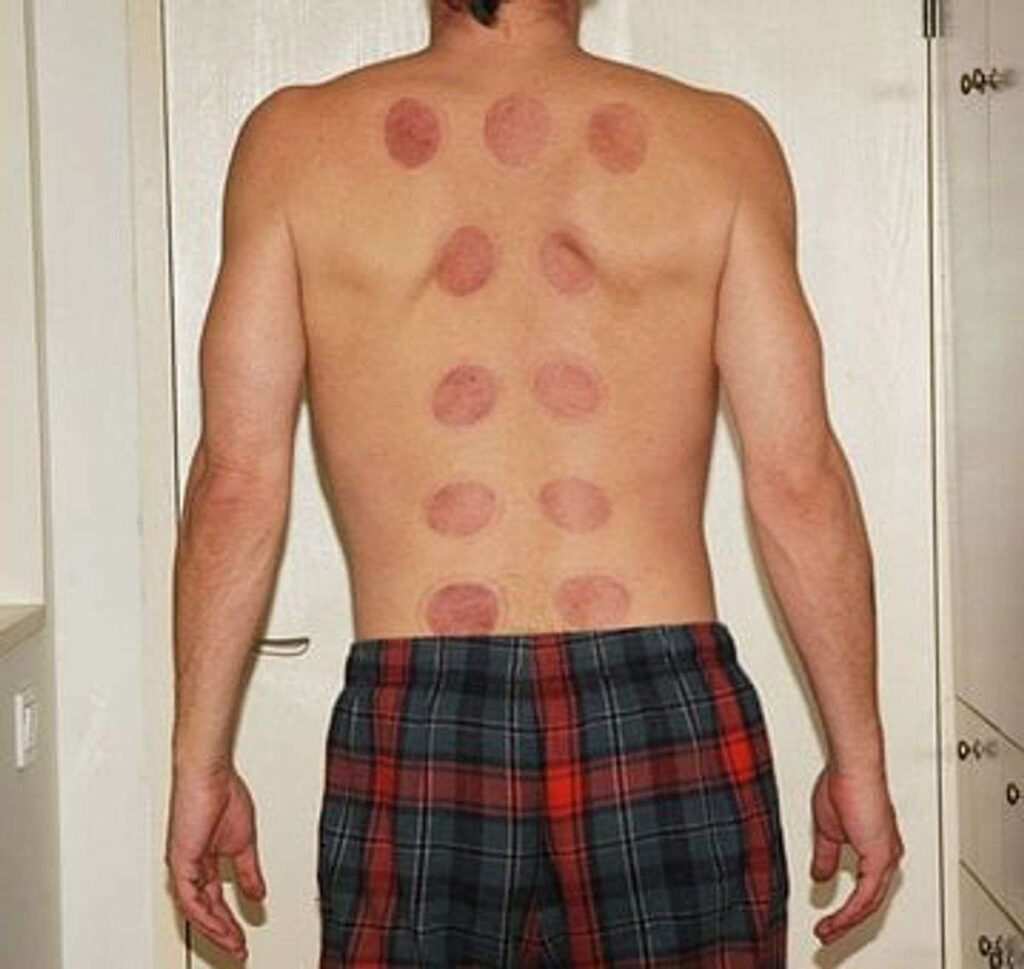 Exactly how Acupuncture Can Help Your Body