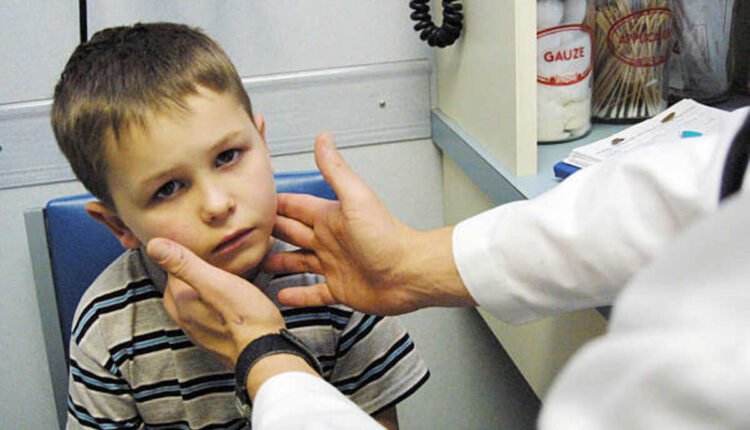 addison's disease