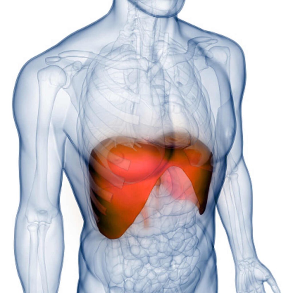 Sarcoidosis