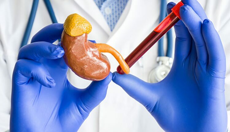 what is creatinine