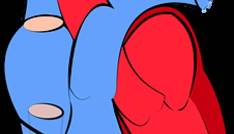 coronary artery disease
