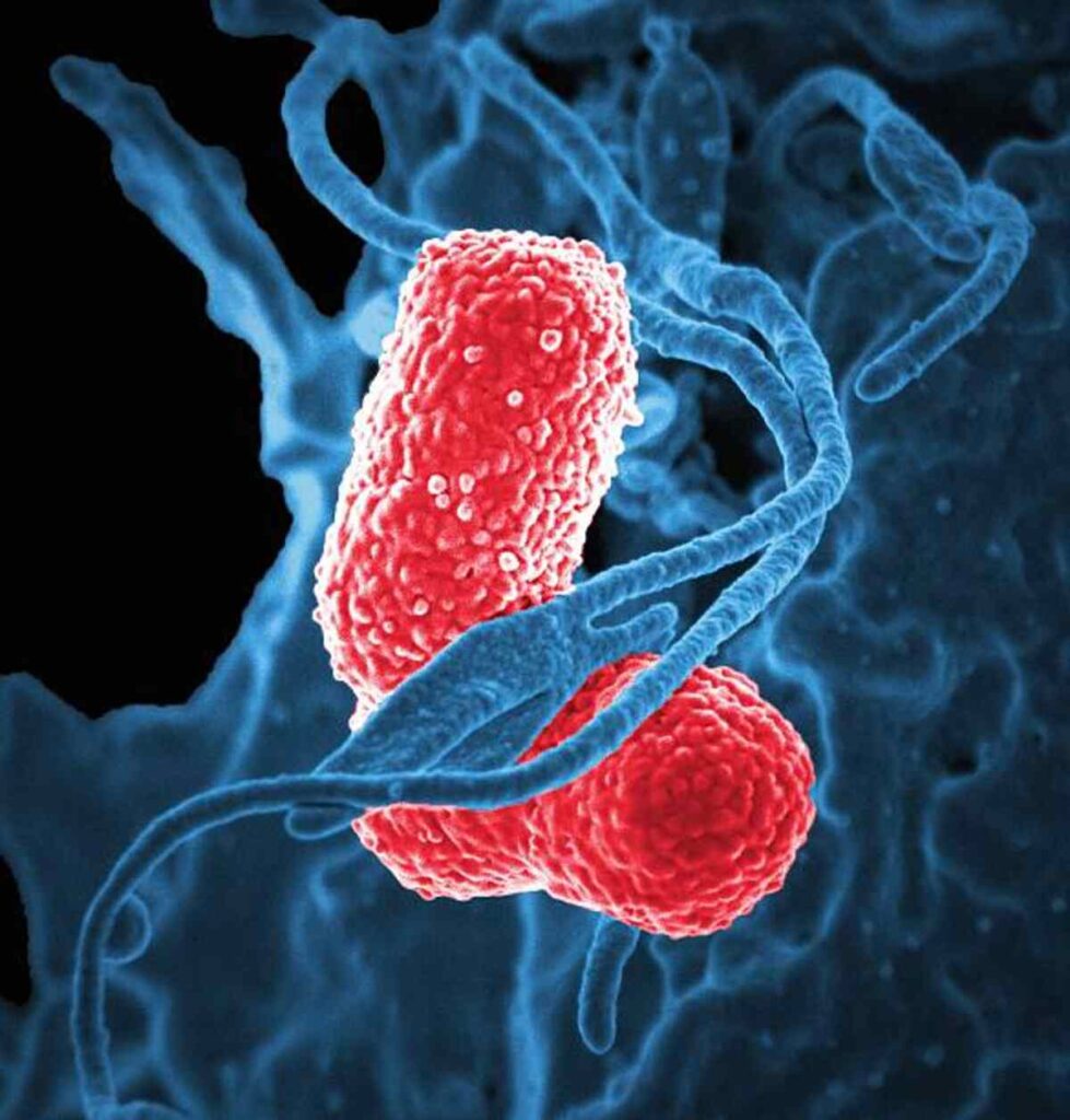What’s Klebsiella Pneumonia?