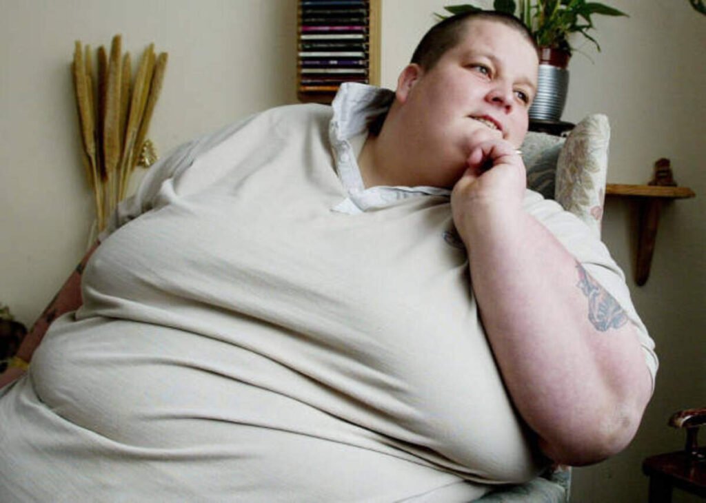 Prader Willi Syndrome