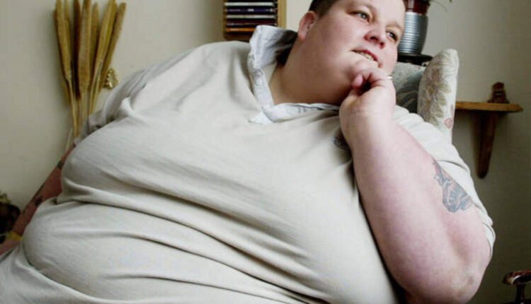 prader willi syndrome