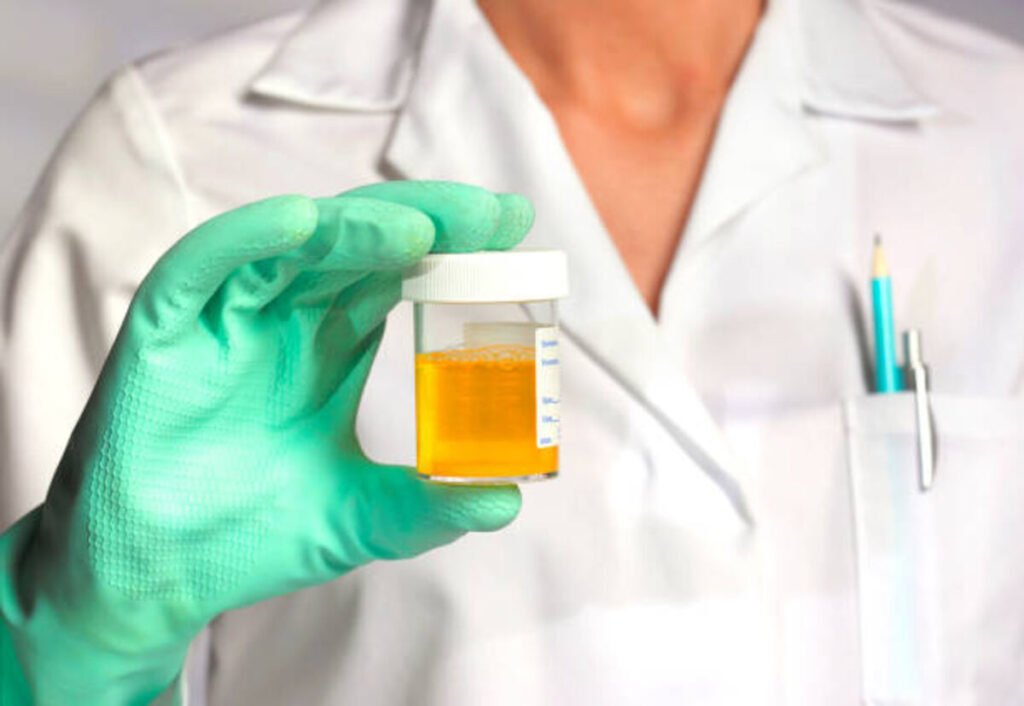 What’s Uric Acid?