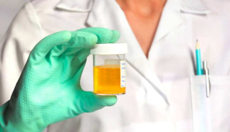 what is uric acid