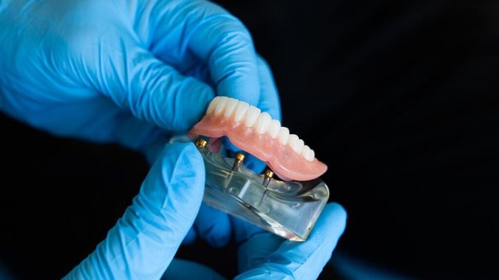Universal Dentistry Reviews – How to Find a Reputable Dental Implant Center