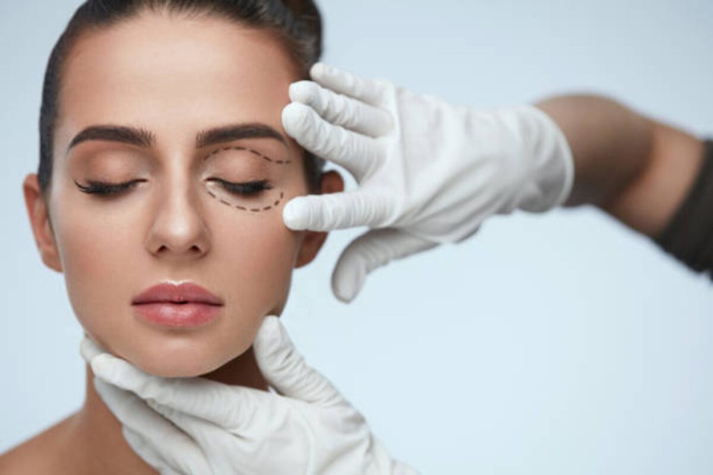 Lower Blepharoplasty Recovery