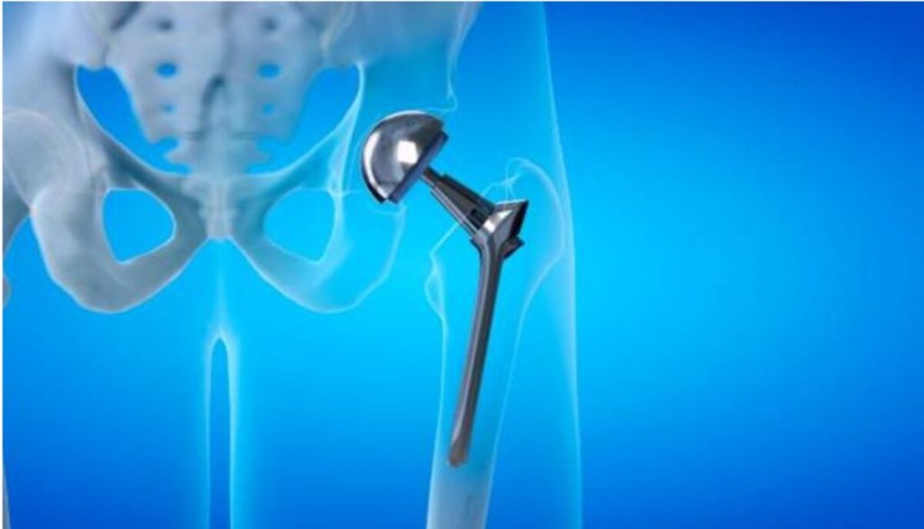 Finding Answers for Fertility Issues